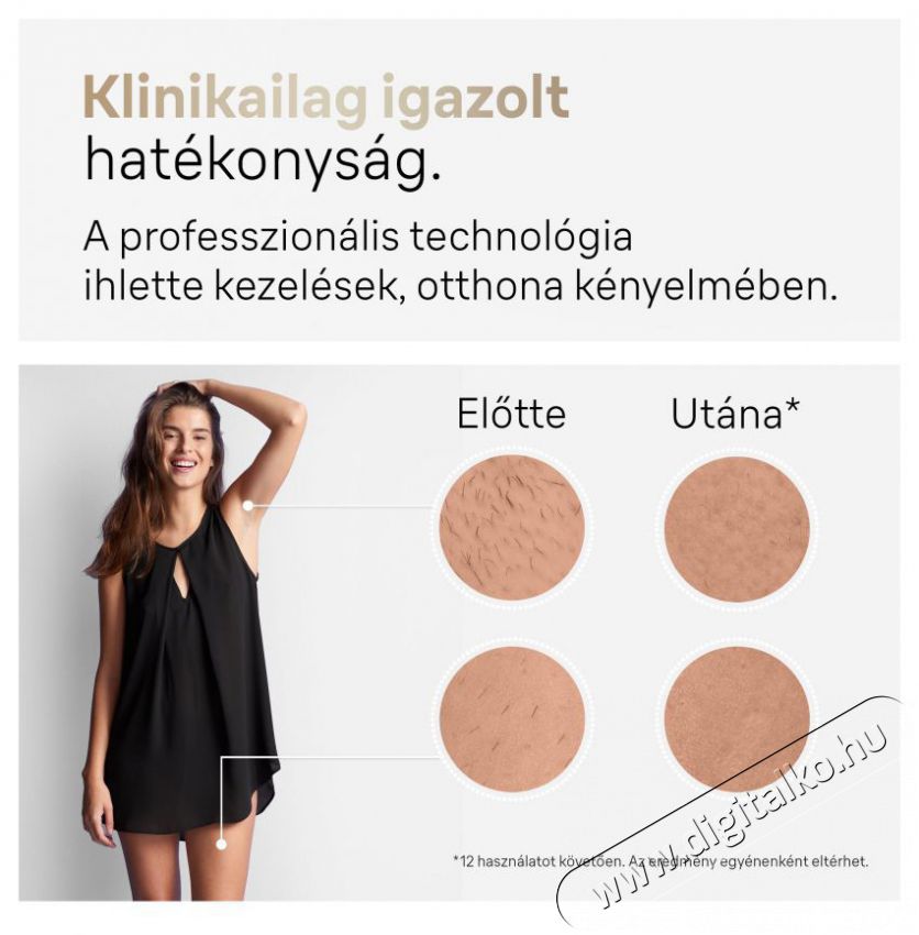 BRAUN IPL Silk-expert Pro 5 PL5382 + tok &eacute;s 4 fej IPL szőrtelen&iacute;tő Sz&eacute;ps&eacute;g&aacute;pol&aacute;s / Eg&eacute;szs&eacute;g - Szőrtelen&iacute;tő / borotva - Női szőrtelen&iacute;tő - 500986