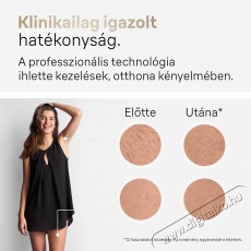 BRAUN IPL Silk&middot;expert Pro 5 PL5242 + tok &eacute;s 3 fej Sz&eacute;ps&eacute;g&aacute;pol&aacute;s / Eg&eacute;szs&eacute;g - Szőrtelen&iacute;tő / borotva - Női szőrtelen&iacute;tő - 500992