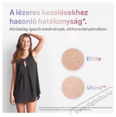 BRAUN Smart IPL Skin I&middot;Expert PL7253 + tok &eacute;s 3 fej Villan&oacute;f&eacute;nyes szőrtelen&iacute;tő Sz&eacute;ps&eacute;g&aacute;pol&aacute;s / Eg&eacute;szs&eacute;g - Szőrtelen&iacute;tő / borotva - Női szőrtelen&iacute;tő - 509835