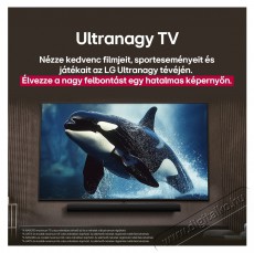 LG 65UA73003 Telev&iacute;zi&oacute;k - LED telev&iacute;zi&oacute; - UHD 4K felbont&aacute;s&uacute; - 518897
