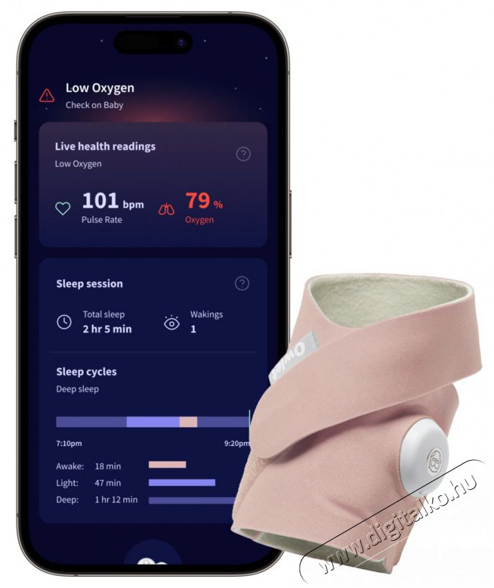 Owlet Dream Sock okos zokni 0-18 h&oacute;napig - R&oacute;zsasz&iacute;n Sz&eacute;ps&eacute;g&aacute;pol&aacute;s / Eg&eacute;szs&eacute;g - Baba mama term&eacute;k - B&eacute;biőr / babafigyelő - 506170