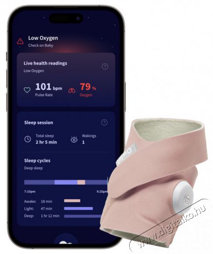 Owlet Dream Sock okos zokni 0-18 h&oacute;napig - R&oacute;zsasz&iacute;n Sz&eacute;ps&eacute;g&aacute;pol&aacute;s / Eg&eacute;szs&eacute;g - Baba mama term&eacute;k - B&eacute;biőr / babafigyelő - 506170